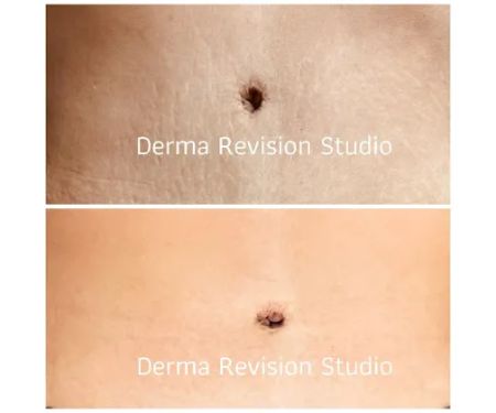 Derma Revision Studio