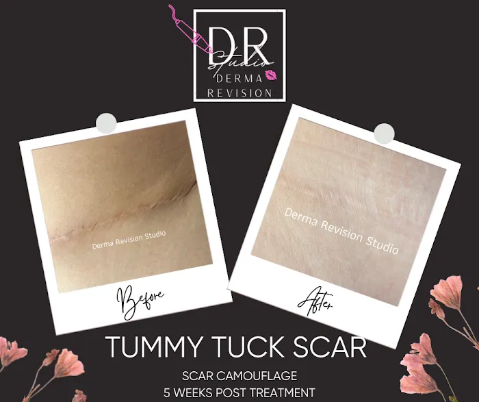 Derma Revision Studio Picture 5