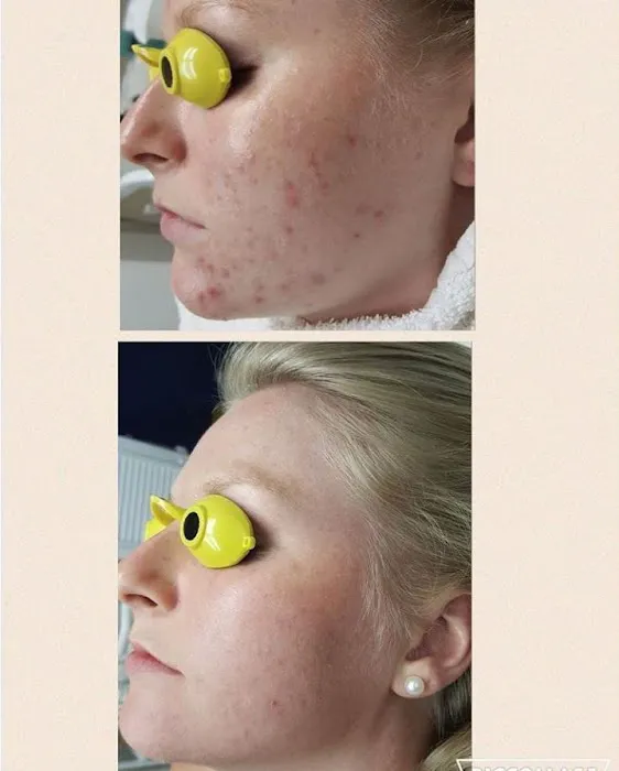 Houston Acne Specialists Picture 5