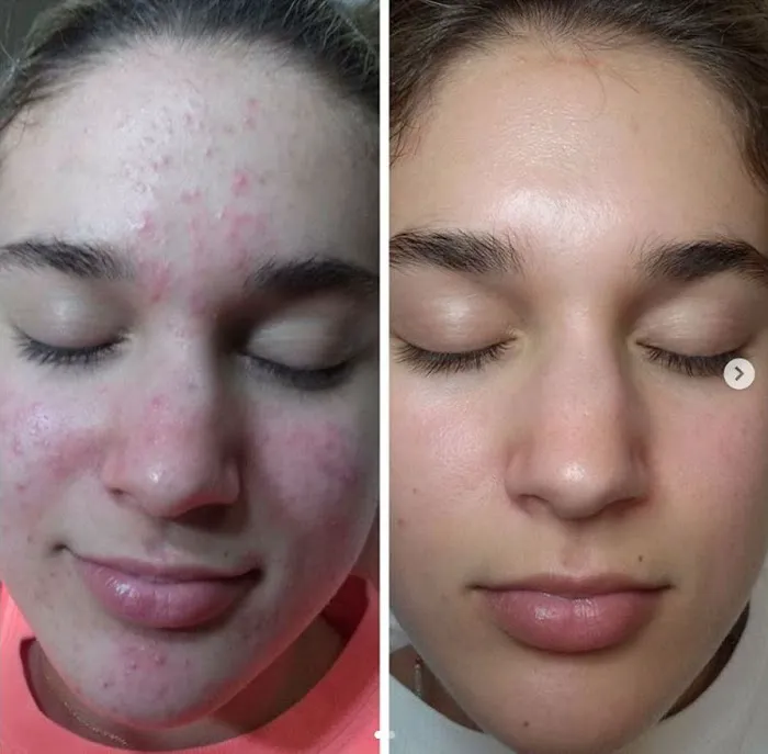 Houston Acne Specialists Picture 7
