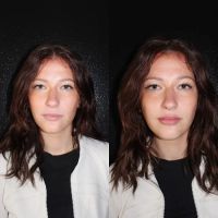 INVASION AESTHETICS ico