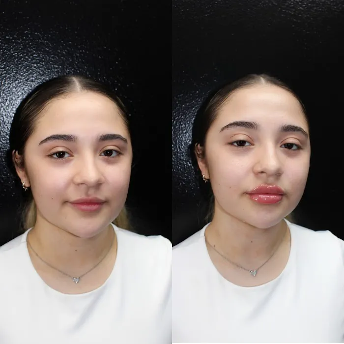 INVASION AESTHETICS Picture 3