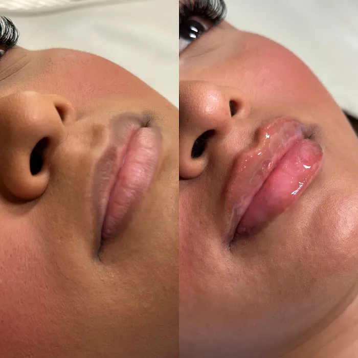 INVASION AESTHETICS Picture 2