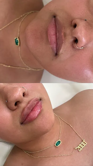 INVASION AESTHETICS Picture 5