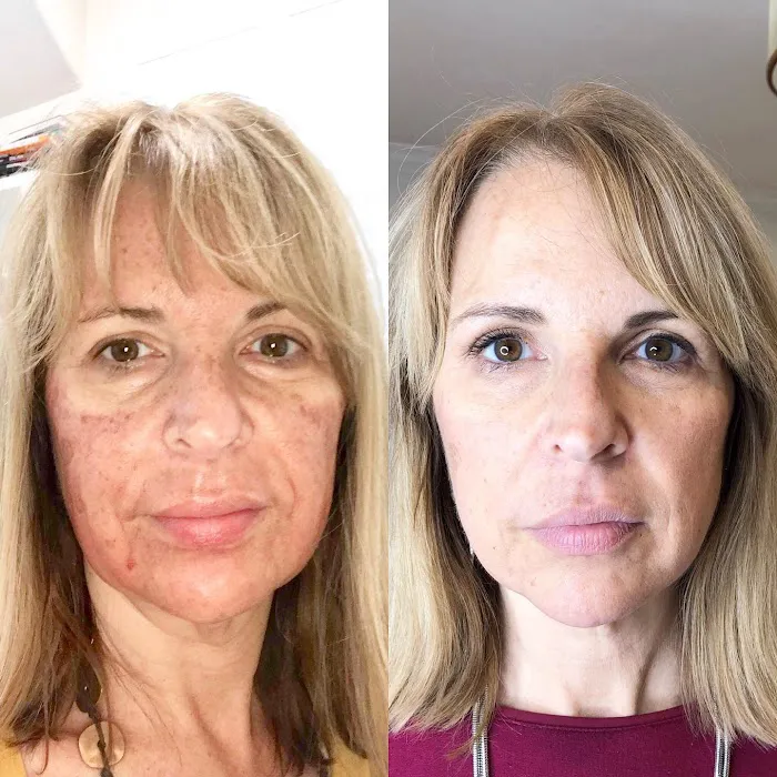 Abby The Esthetician (Tanglewood) Picture 8