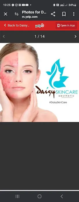 Daisy Skin Care Houston Picture 2