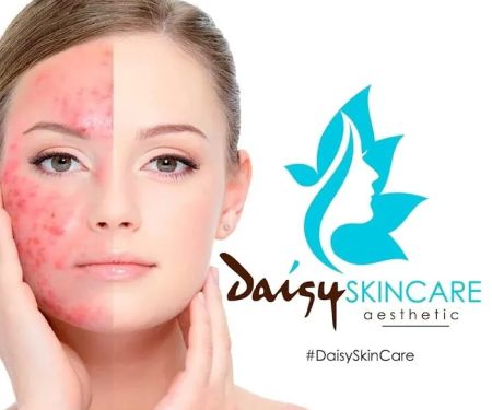 Daisy Skin Care Houston