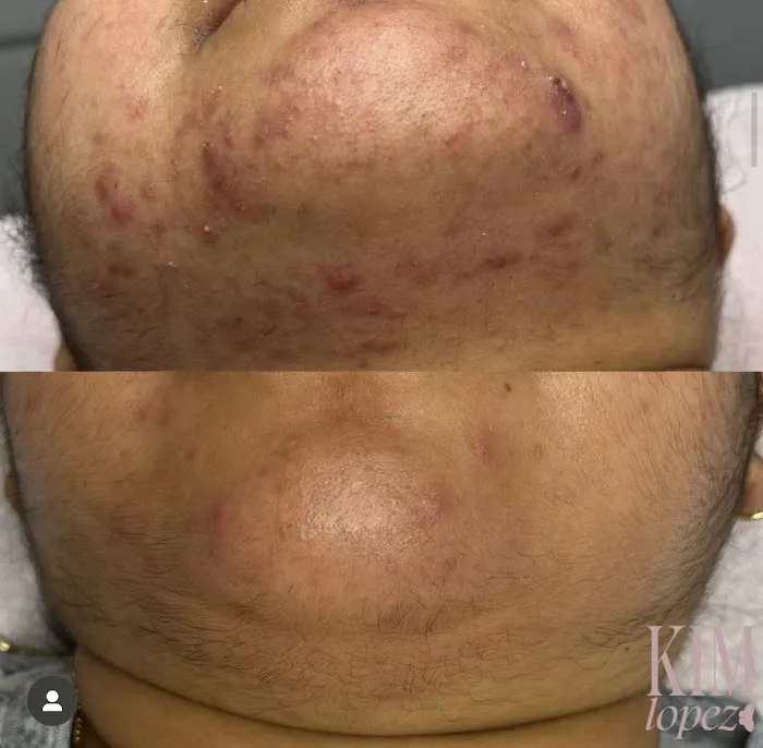 Skin by Kim Lopez Picture 6