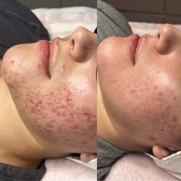 Skin by Kim Lopez Picture 7