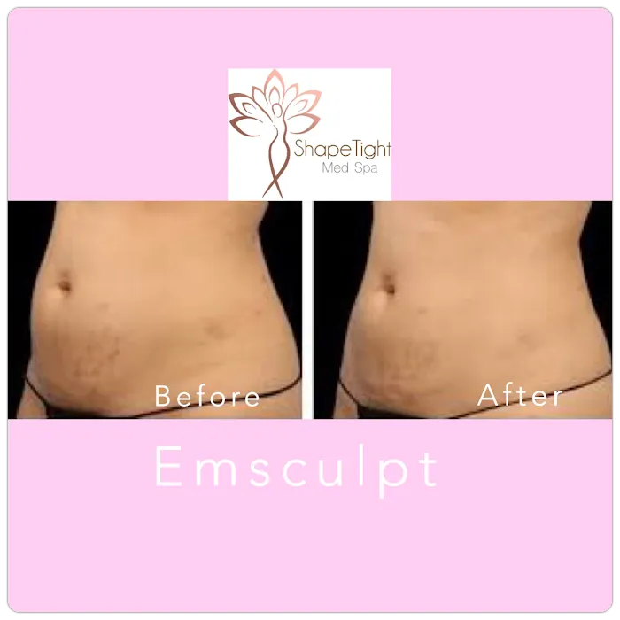 Shape Tight Medical Spa Picture 5