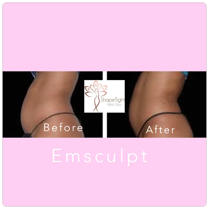 Shape Tight Medical Spa Picture 1