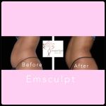 Shape Tight Medical Spa