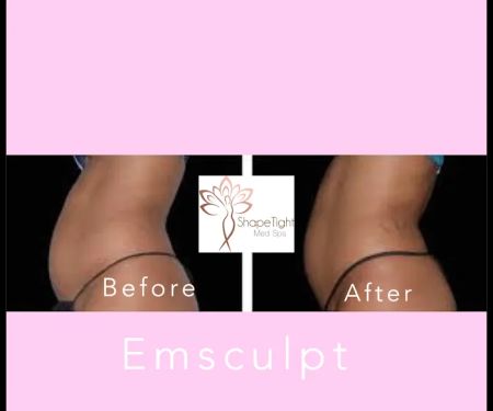 Shape Tight Medical Spa
