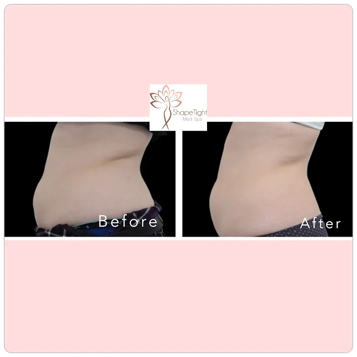 Shape Tight Medical Spa Picture 4