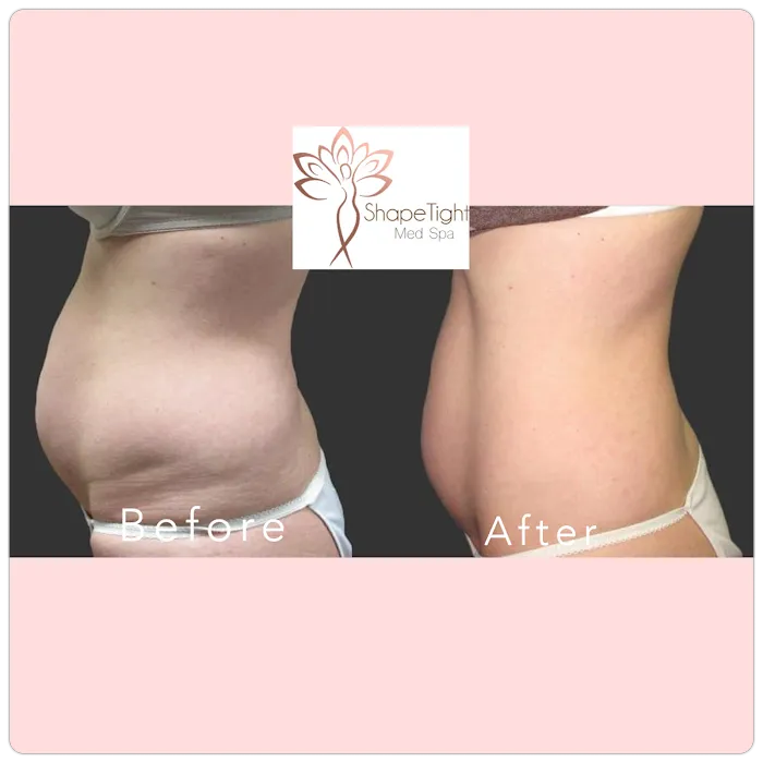 Shape Tight Medical Spa Picture 6