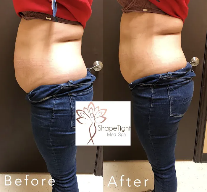 Shape Tight Medical Spa Picture 3