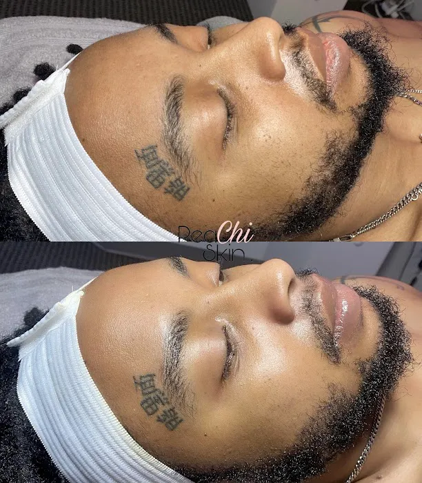 Peachi Skin Picture 3