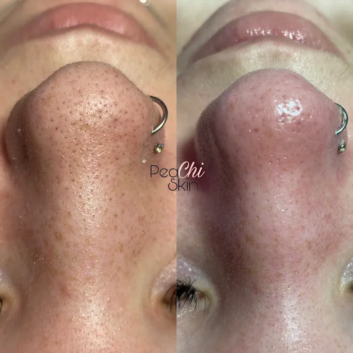 Peachi Skin Picture 4