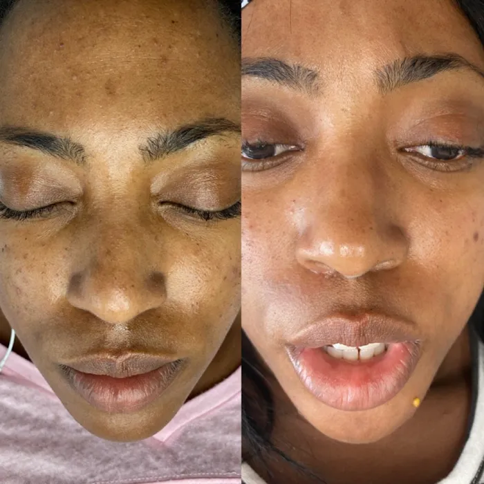 Lotus Skin Spa Picture 4