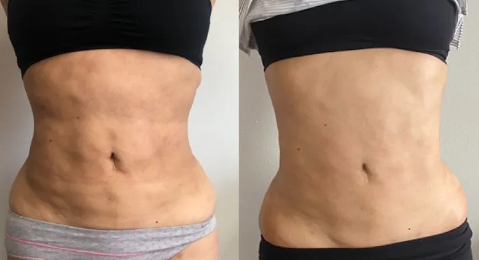 Lotus Skin Spa Picture 5