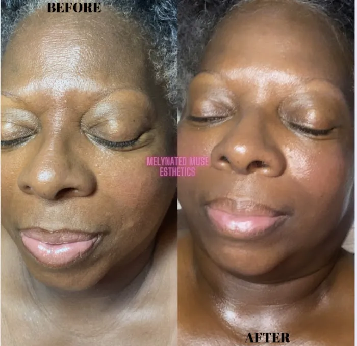 Melynated Muse Esthetics Picture 6