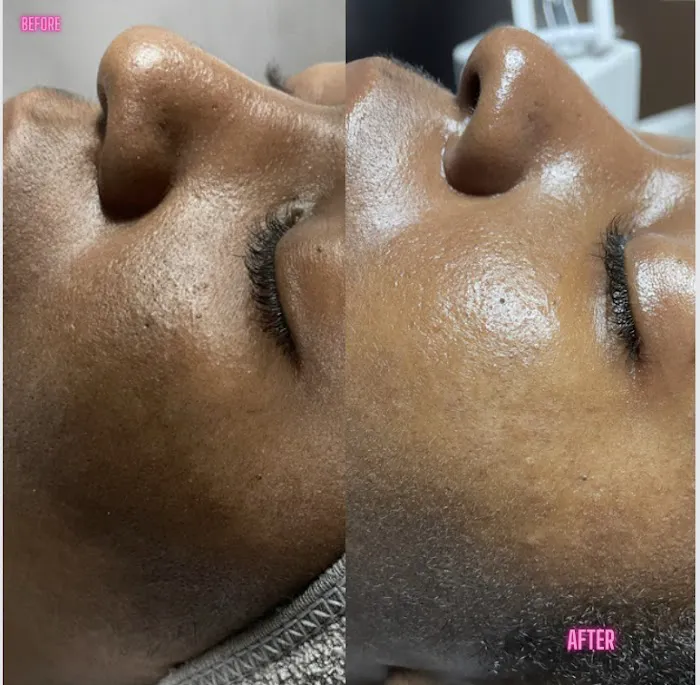 Melynated Muse Esthetics Picture 2