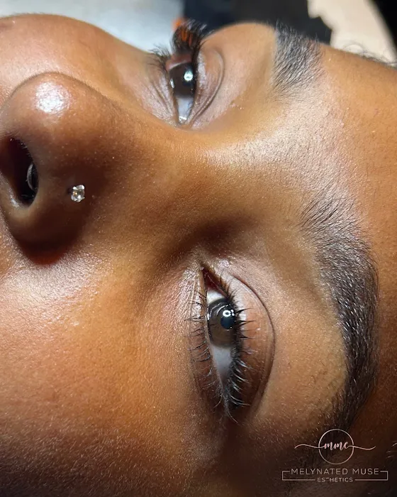 Melynated Muse Esthetics Picture 10