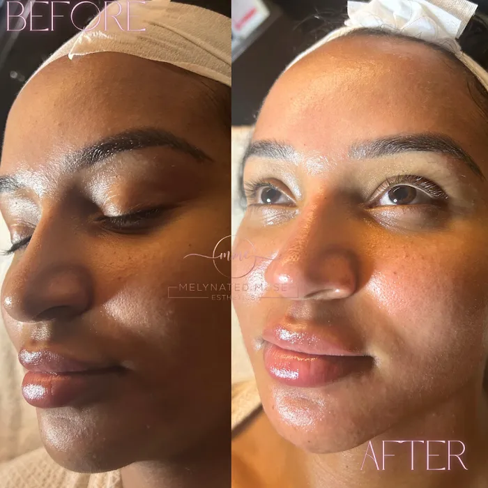 Melynated Muse Esthetics Picture 9