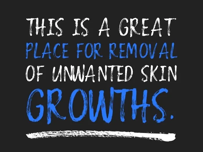 Sonic Skin Care Houston Laser Skin Growth And Mole Removal Picture 1