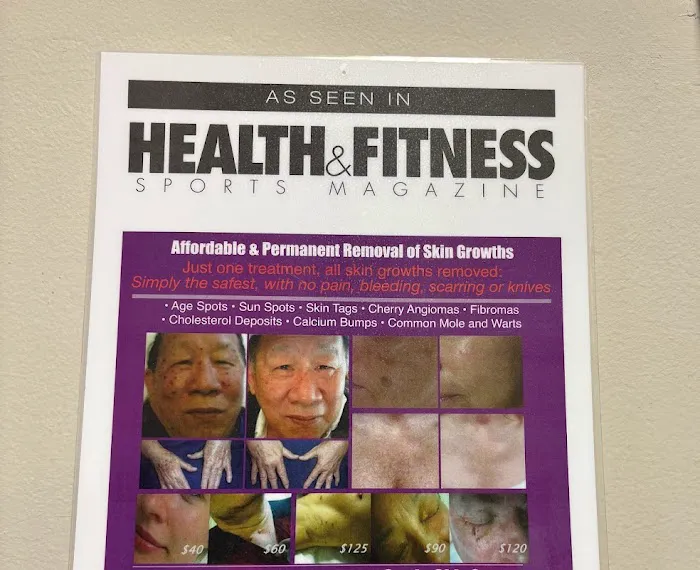 Sonic Skin Care Houston Laser Skin Growth And Mole Removal Picture 8