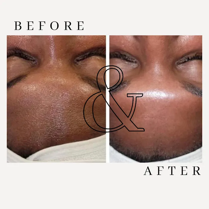 Le Beau Effet Picture 6