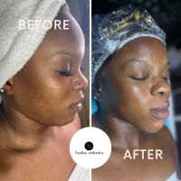 Teekay Esthetics LLC ico