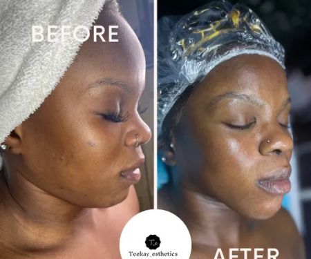 Teekay Esthetics LLC