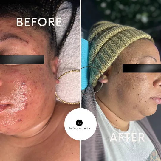 Teekay Esthetics LLC Picture 4