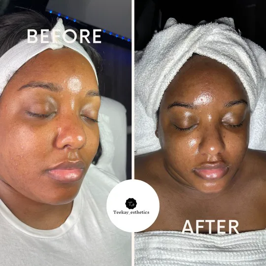 Teekay Esthetics LLC Picture 9