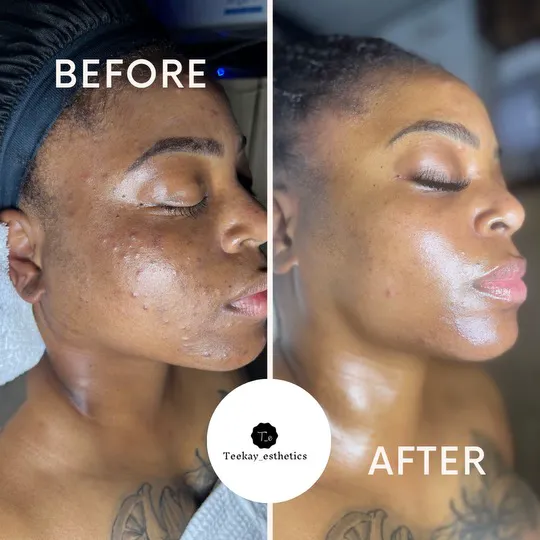 Teekay Esthetics LLC Picture 6