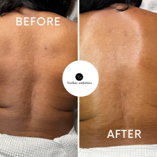 Teekay Esthetics LLC Picture 7