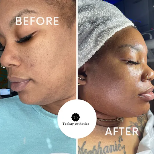 Teekay Esthetics LLC Picture 8