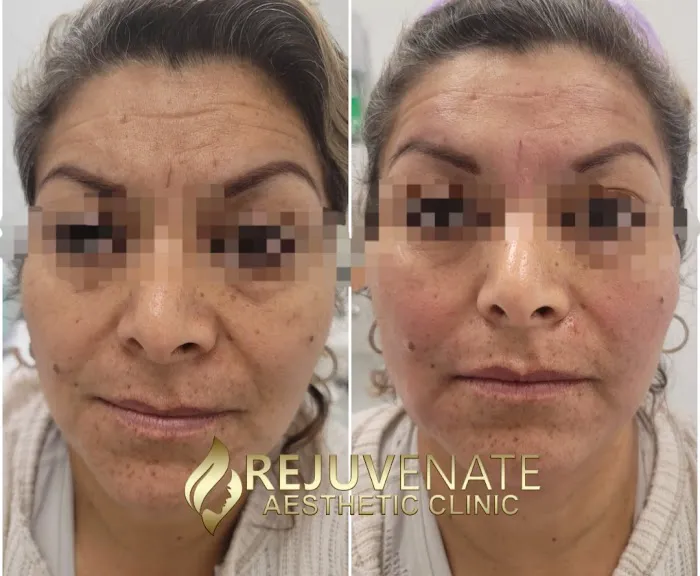 Rejuvenate Aesthetics Clinic Picture 7