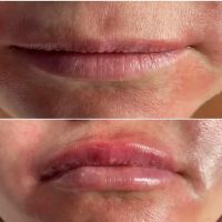 Rejuvenate Aesthetics Clinic ico