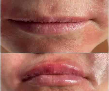 Rejuvenate Aesthetics Clinic