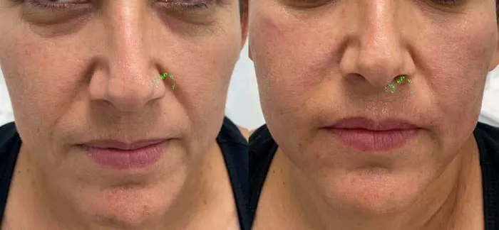 Rejuvenate Aesthetics Clinic Picture 2