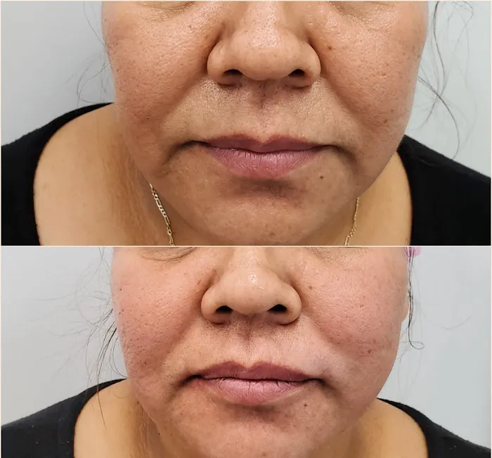 Rejuvenate Aesthetics Clinic Picture 3