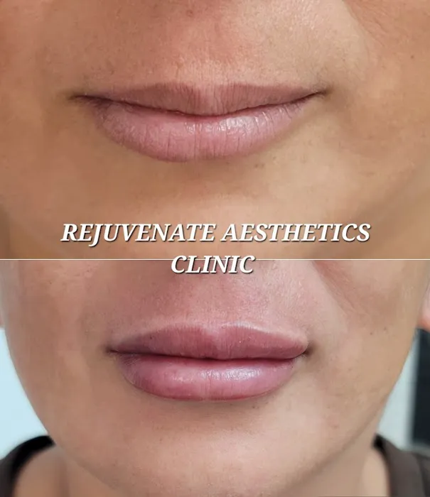 Rejuvenate Aesthetics Clinic Picture 6