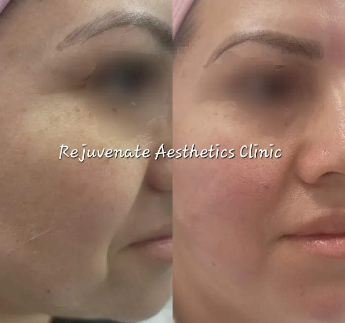 Rejuvenate Aesthetics Clinic Picture 8
