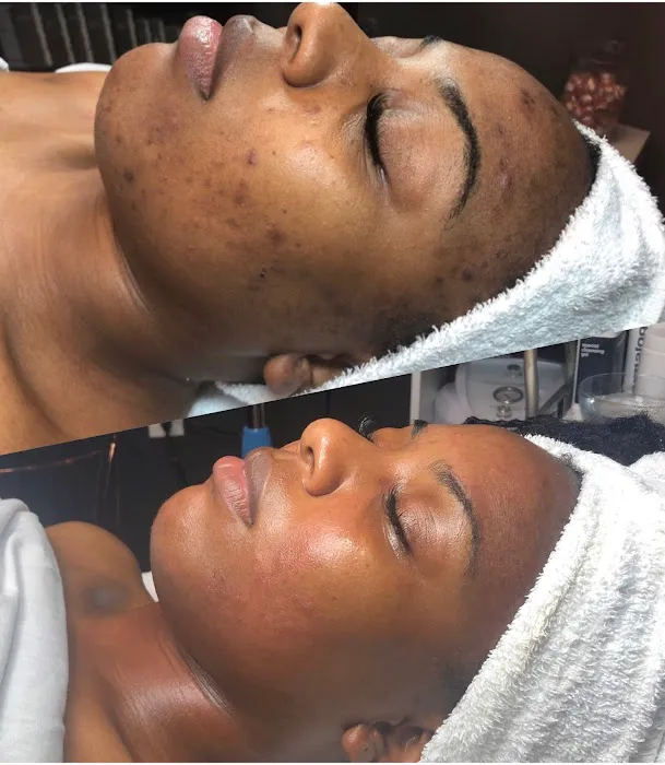 Angelic Skin Picture 1