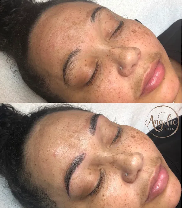 Angelic Skin Picture 4