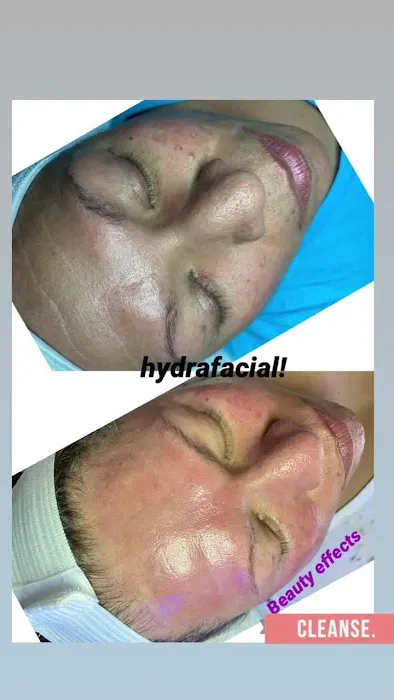 Beauty Effects Picture 7