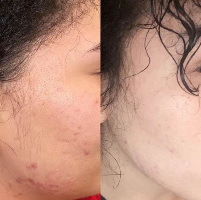 Esthetic Shades Picture 1