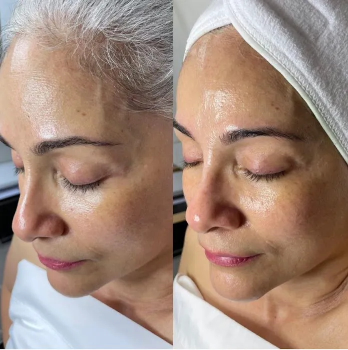 Esthetic Shades Picture 4